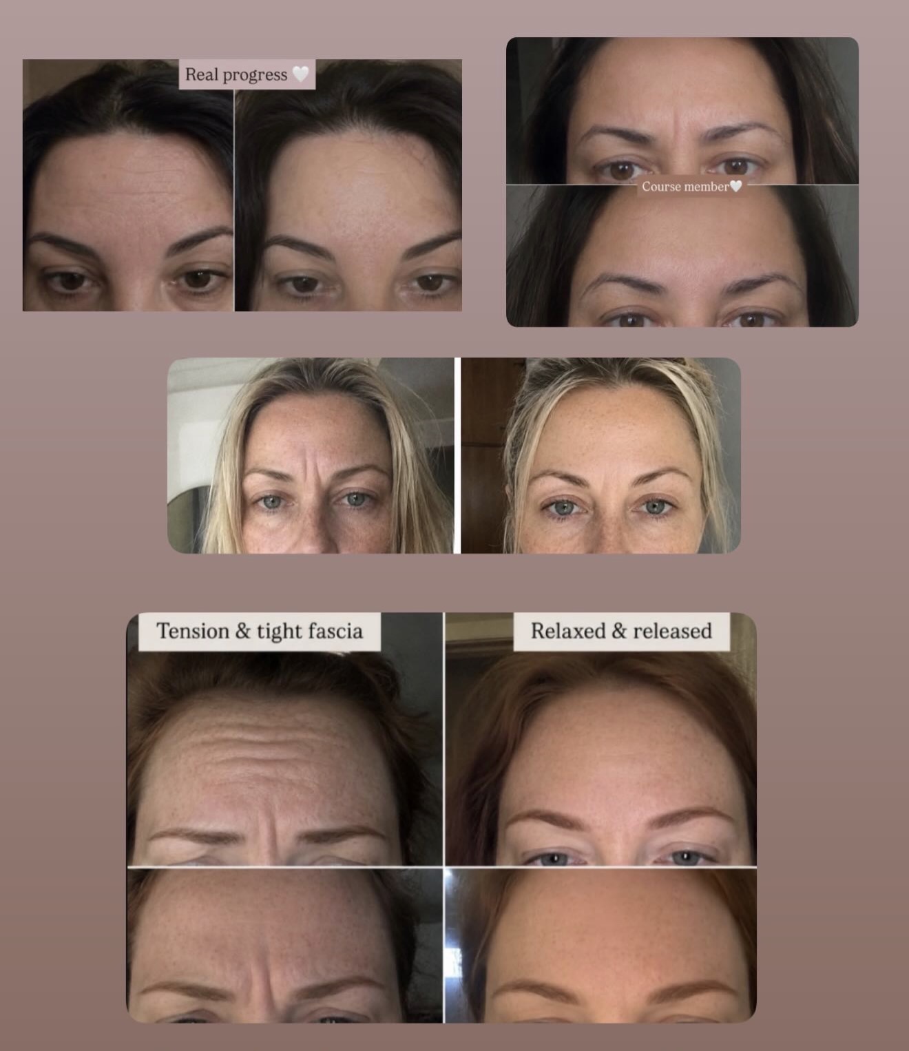 Collage of real course members showing forehead and facial progress