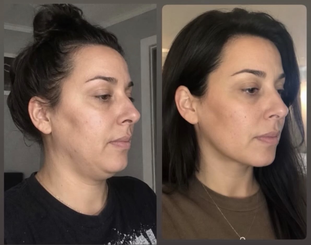 Before and after facial wellness practice, example 2