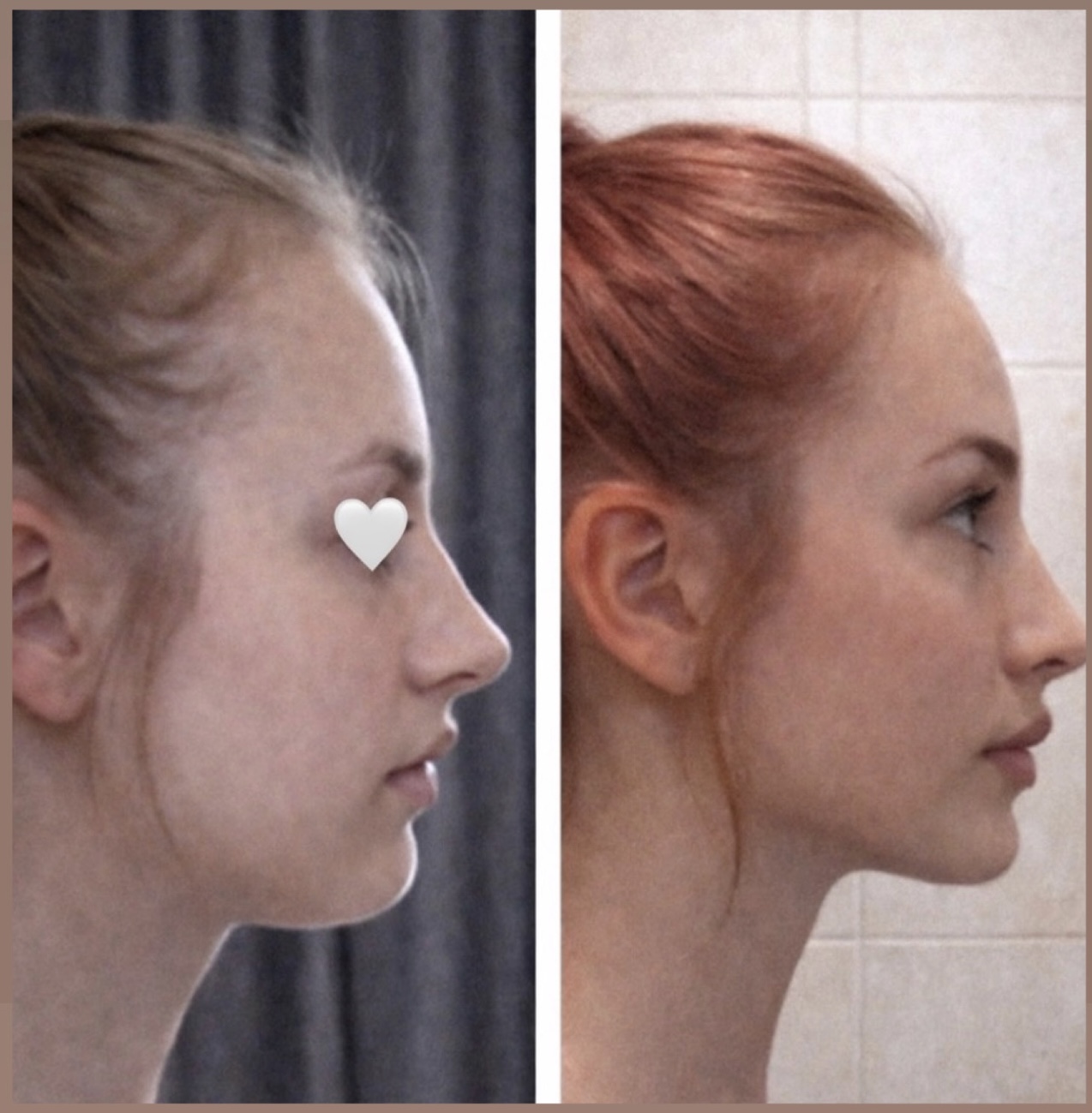Before and after facial wellness practice, example 1